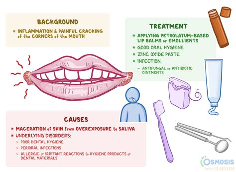 Angular cheilitis: Causes, symptoms, treatment and。